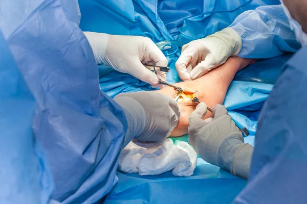 Grupo de cirujanos que realizan una cirugía de codo — Foto de Stock