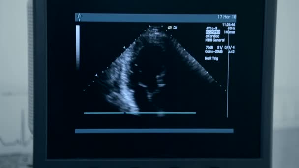 Máquina de ultrasonido con monitor. Examen del corazón — Vídeos de Stock