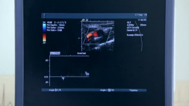 Ultrason makine İzleyicisi ile. Kalp incelenmesi