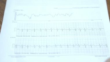 Belirtiler analiz. Doktor kardiyogram okuyor