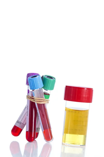 Urin dan sampel darah — Stok Foto