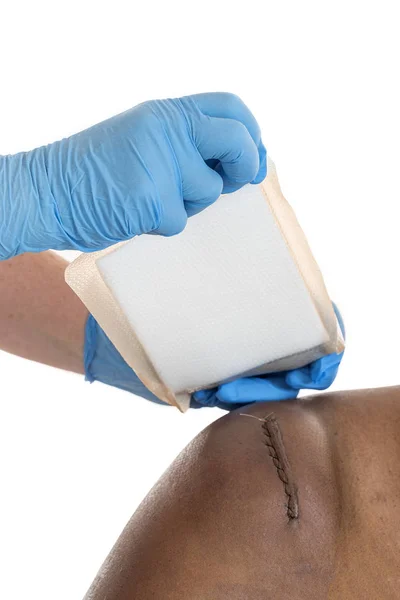 Sticking-plaster was applied to awound sitched scar on white — Stock Photo, Image