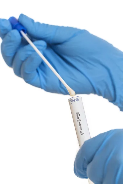 DNS-vizsgálat a biotechnológia vizsgálat samplee. — Stock Fotó
