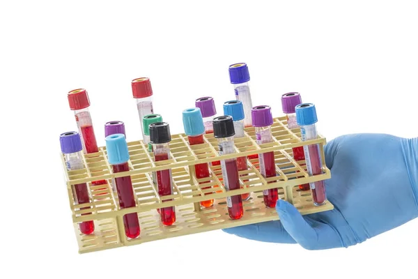 Médico ou técnico de laboratório mão segurando um rack de tubos de teste de amostra de sangue para laboaratory em branco — Fotografia de Stock