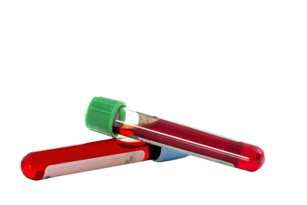 Échantillon de sang : deux baignoires de test bloo sur fond blanc — Photo