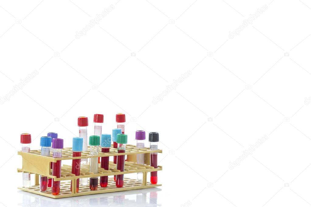 view from of a bic rack of blood sample test tubes on a white background copy text