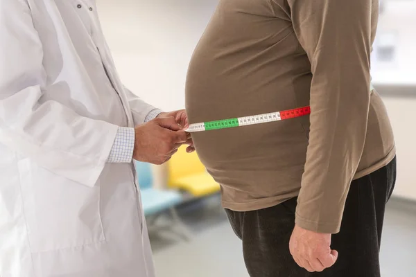 Dokter zwaarlijvige man taille lichaamsvet te meten. Obesitas en gewichtsverlies. — Stockfoto