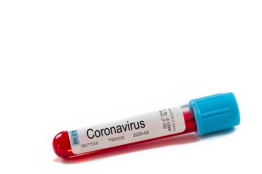 Makro kan örneği beyaz arka planda test tüpünde. Salgın Mers-Cov Coronavirus Araştırma ve Tedavi Konsepti