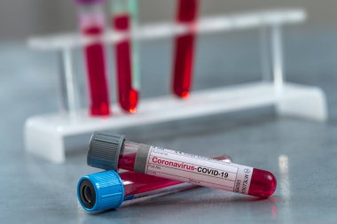 Kan, virüs konsepti, salgın ve Cov virüsünün yayıldığı tıbbi laboratuvar test tüpü.
