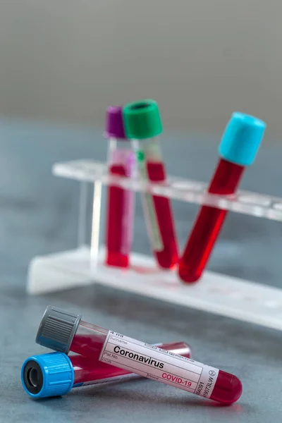 Tubo de teste de laboratório médico com sangue, conceito de virologia, epidemia, disseminação do vírus CoV — Fotografia de Stock