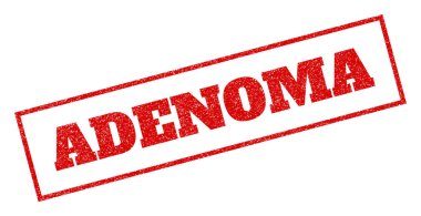 Adenom pencere boyutu