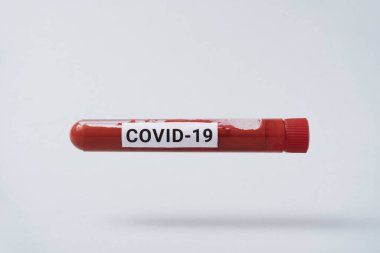 Yeni Corona virüsü enfeksiyonunun teşhisi için en az COVID-19 testi ve laboratuvar örneği (Corona virüsü hastalığı). Bulaşıcı salgın konsepti.