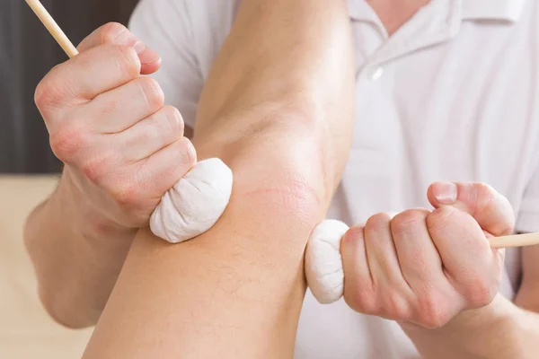 Massage mit Kräuterbeutel des Kniegelenks des Patienten — Stockfoto