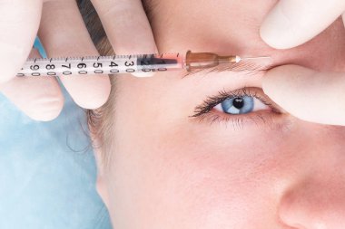 Güzellik uzmanı alnındaki kırışıklıkları hyaluronik asitle kaplıyor.