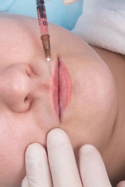 Eldivenli eller burun kıvrımlarına ilaç enjekte ederek yüz kırışıklıklarını düzeltir.