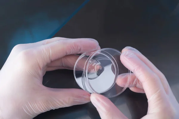 Tle Rentgena Człowieka Ręce Naukowca Trzymają Szalkę Petriego Biomateriałami — Zdjęcie stockowe