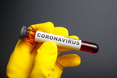 Test tüpü tutan lastik eldiveni ve olası koronavirüsünün analizi için tüpte kan olan eldiveni teslim edin. Sığ Dof