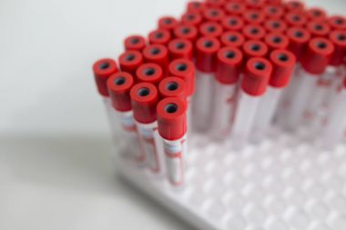 Laboratuvar plastik test tüpleri bir bilim araştırma laboratuarında bir deney için. Yakın çekim