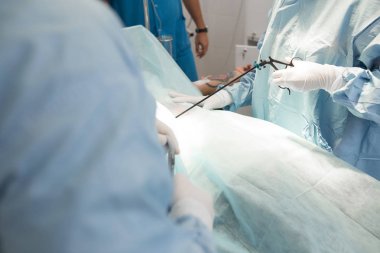 Doktor ve yardım tıbbi ekip operasyon odasında bir hastanın ameliyat. laparoskopi için aygıtlar. cerrah hastane veya klinik çalışma. Tıp, acil durum kavramı