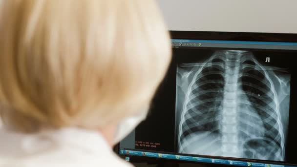 Profissional médico lendo filme de raios-x do cérebro e no telefone 4k — Vídeo de Stock