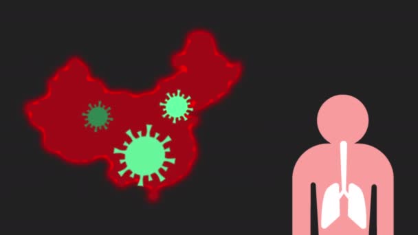 चीनमध्ये कोरोना व्हायरसची लागण झाली आहे. अॅनिमेशन व्हिडिओ — स्टॉक व्हिडिओ
