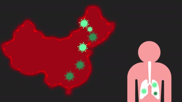 Epidemie koronaviru v Číně. Animační video — Stock video