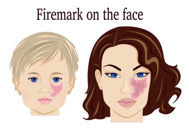 Firemark on the face clipart