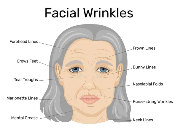 老年妇女脸上皱纹类型的图解 — 图库矢量图片