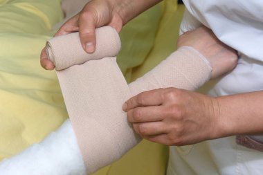Lymphedema management: Wrapping Lymphedema Hand and Arm using multilayer bandages to control Lymphedema. Part of complete decongestive therapy (cdt) and manual lymphatic drainage (MLD) clipart