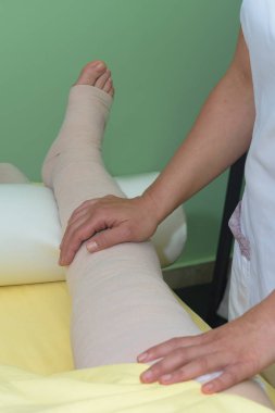 Lenf kanseri yönetimi: Lenf kanserini kontrol etmek için çok katmanlı bandaj kullanarak bacağı sarmak. Tam dekonjestif tedavi (cdt) ve manuel lenfatik drenajın bir parçası (Mld)