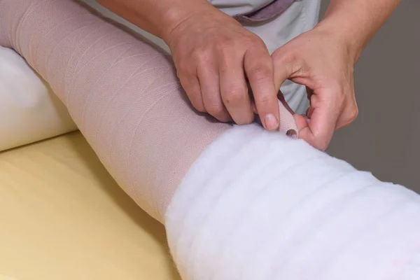 Manejo Del Linfedema Envolver Pierna Usando Vendajes Multicapa Para Controlar — Foto de Stock