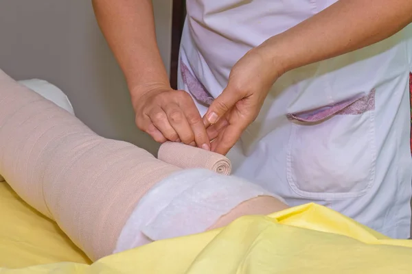 Manejo Del Linfedema Envolver Pierna Usando Vendajes Multicapa Para Controlar — Foto de Stock