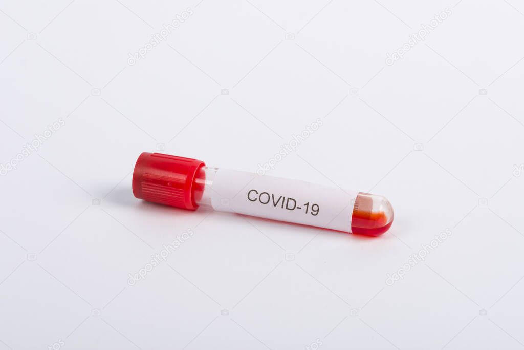 Coronavirus 2019-nCoV Blood Sample in test tubes. Corona virus outbreaking. Epidemic virus Respiratory Syndrome, China. Researching and treatment concept.