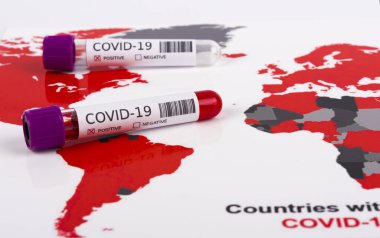 Coronavirus ve seyahat konsepti. Coronavirüs salgını, Wuhan, Çin 'de salgın. Seyahat kısıtlamaları ve karantina. COVID-19 vakası olan ülkeleri gösteren bir dünya haritasındaki bir tüpteki kan örneği