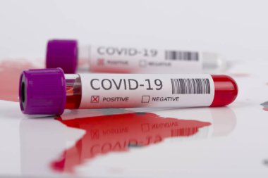 Coronavirus ve seyahat konsepti. Coronavirüs salgını, Wuhan, Çin 'de salgın. Seyahat kısıtlamaları ve karantina. COVID-19 vakası olan ülkeleri gösteren bir dünya haritasındaki bir tüpteki kan örneği