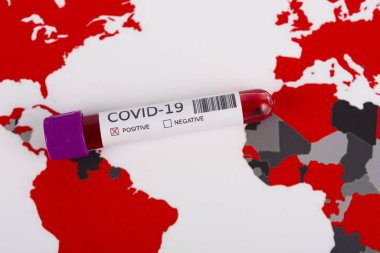 Coronavirus ve seyahat konsepti. Coronavirüs salgını, Wuhan, Çin 'de salgın. Seyahat kısıtlamaları ve karantina. COVID-19 vakası olan ülkeleri gösteren bir dünya haritasındaki bir tüpteki kan örneği
