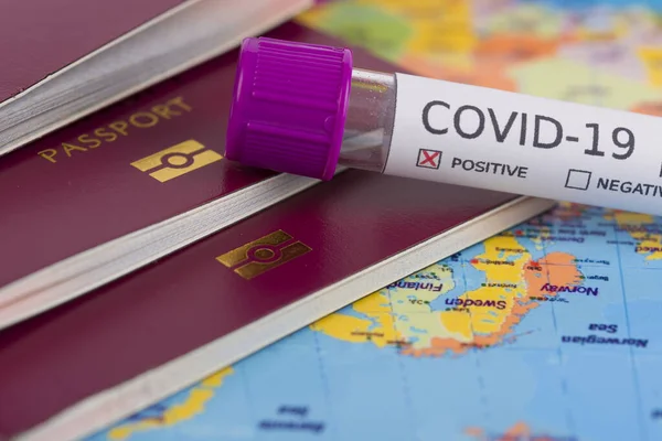 Coronavirus ve seyahat konsepti. Wuhan, Çin 'de salgın hastalık. COVID-19 vakası olan ülkeleri gösteren dünya haritası. Tüpte kan örneği, dünya haritası, pasaport ve maske. Seyahat kısıtlamaları ve karantina