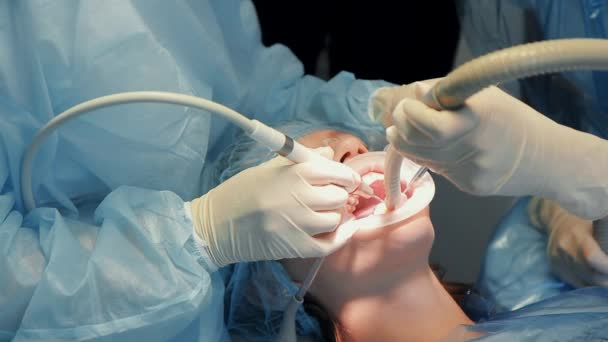 Врач-стоматолог с ассистентом проводит процедуру отбеливания зубов — стоковое видео