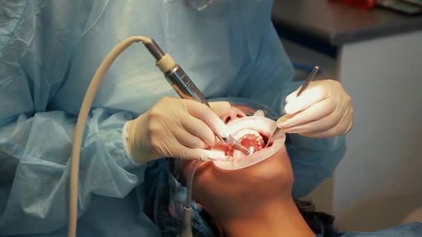 Лікар стоматолог виконує відбілювання зубів дівчині-пацієнту — стокове відео