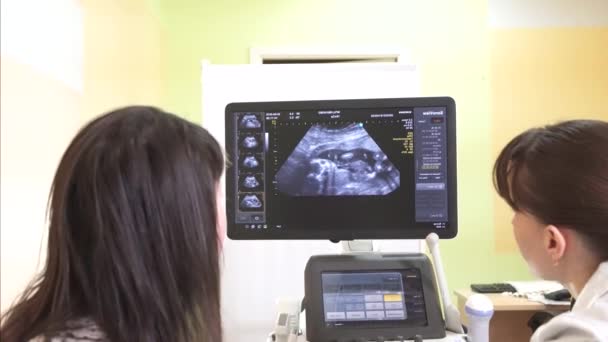 Girl on ultrasound at the doctors office look at the monitor — Stock Video