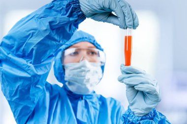 Tehlikeli madde koruma giysisi içindeki sıhhiye, Çin, Wuhan 'dan alınan koronavirüs pozitif kan örneğinin bulunduğu bir test tüpü tutuyor. 2019 ncov salgını. Coronavirüs 'ü durdurun. Mers.