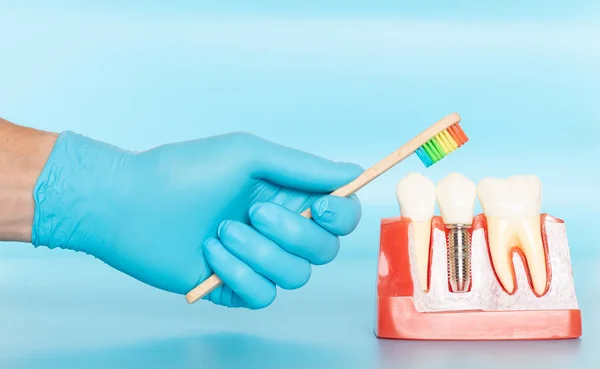 천연 치아 와 비교하여 치아 삽 입물의 플라스틱 표본. — 스톡 사진