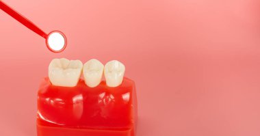 Açıklamada kullanılacak implantlar ve diş aletlerine örnek hastalara tedavi süreci hakkında bilgi verilsin.