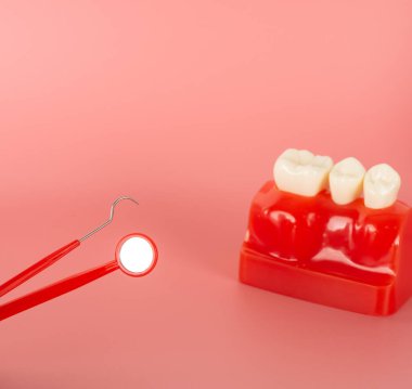 Açıklamada kullanılacak implantlar ve diş aletlerine örnek hastalara tedavi süreci hakkında bilgi verilsin.