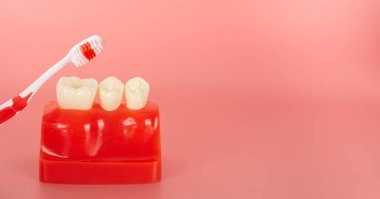 Açıklamada kullanılacak implantlar ve diş aletlerine örnek hastalara tedavi süreci hakkında bilgi verilsin.