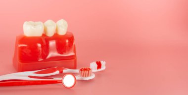 Açıklamada kullanılacak implantlar ve diş aletlerine örnek hastalara tedavi süreci hakkında bilgi verilsin.