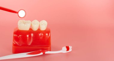 Açıklamada kullanılacak implantlar ve diş aletlerine örnek hastalara tedavi süreci hakkında bilgi verilsin.