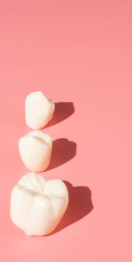 Diş implantlarından alınan örnekler diş implantlarının silikon bileşenlerini gösteriyor. Hastanın diş etlerine yerleştirildiğinde hastanın tedaviye başlamadan önce anlaması için..