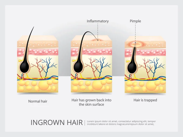 Ingegroeide Haren Structuur Vectorillustratie — Stockvector