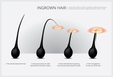 Saç Temizleme Örnek Vektör İllüstrasyonu